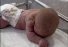Baby born with an DIU peg… See more