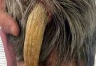 What Doctors Found Growing On The Back Of His Head Left Everyone Speechless