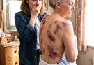 When I came home to visit my elderly mother, I offered to help her bathe. Instead of smiling, she recoiled in fear. “Please… don’t take off my coat,” she whispered, shaking. The moment I gently slipped it from her shoulders, I uncovered deep br:ui:ses and rop:e marks across her frail body. Then she told me what my brother and sister-in-law had been doing behind closed doors. I never raised my voice. I simply picked up my phone and made one call that changed their lives forever.