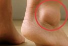 Understanding Swollen Feet in Seniors and Ways to Reduce It