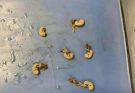 Hidden Seeds Food Warning