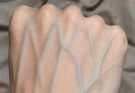 If your veins are visible in your hand, it is a signal